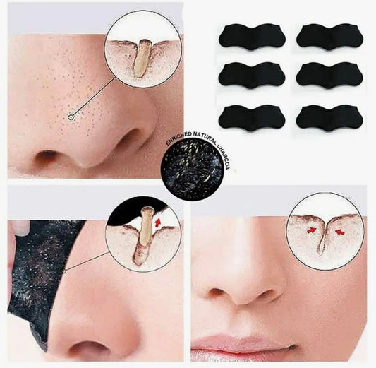 Blackhead Remover Nose Strips